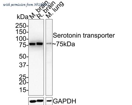 HUABIO HA721544 image 1