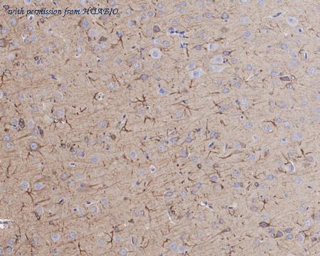 HUABIO HA721550 image 2