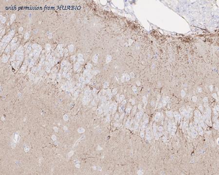 HUABIO HA721550 image 3