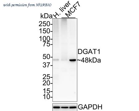 HUABIO HA721555 image 1
