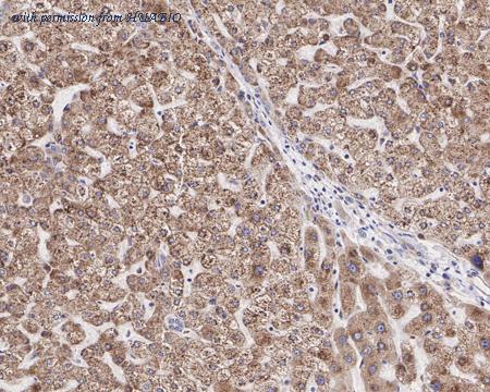 HUABIO HA721555 image 3