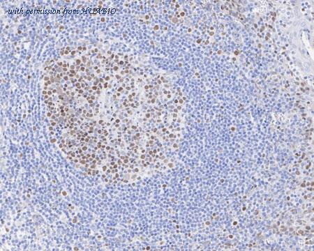 HUABIO HA721557 image 2