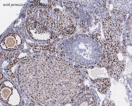 HUABIO HA721558 image 3