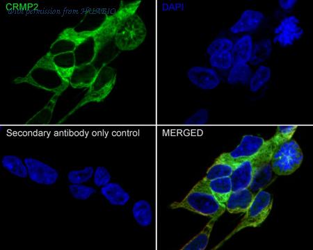 HUABIO HA721560 image 2