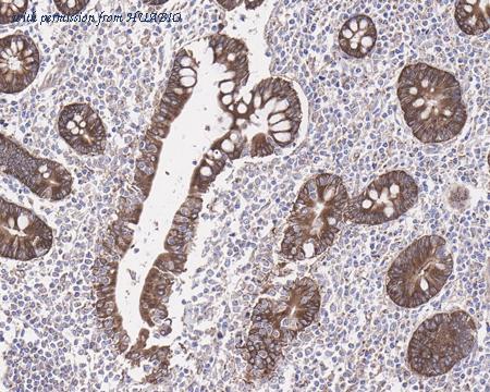 HUABIO HA721561 image 2