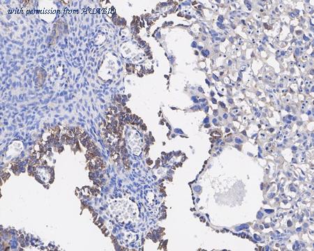 HUABIO HA721562 image 2