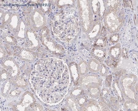 HUABIO HA721563 image 2