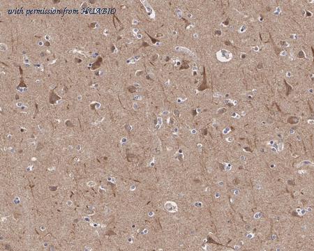 HUABIO HA721581 image 3