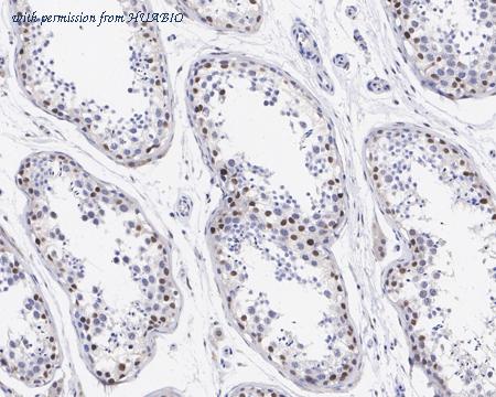 HUABIO HA721585 image 3