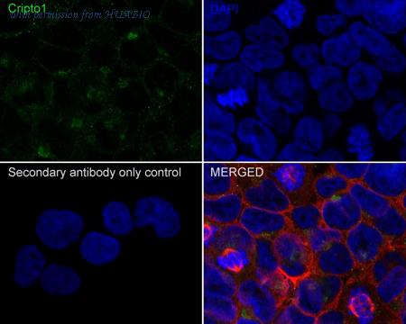 HUABIO HA721587 image 2