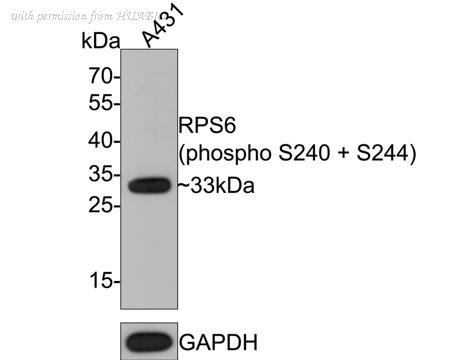 HUABIO HA721589 image 1