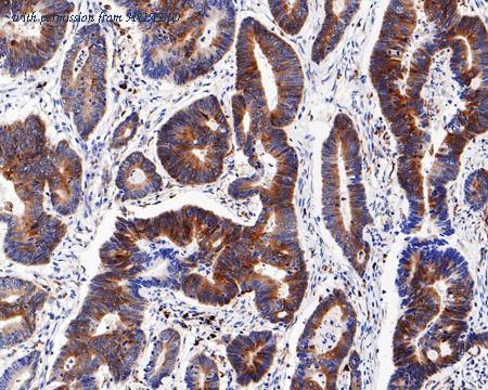 HUABIO HA721589 image 2