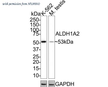 HUABIO HA721592 image 1