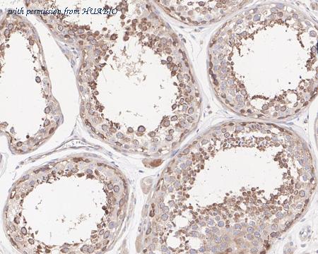 HUABIO HA721592 image 3