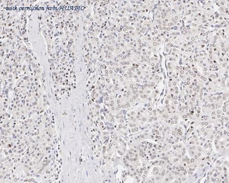 HUABIO HA721627 image 3