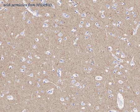 HUABIO HA721630 image 2