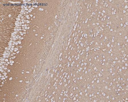 HUABIO HA721630 image 3