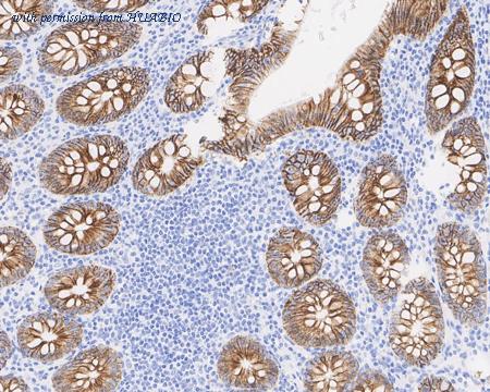 HUABIO HA721643 image 2