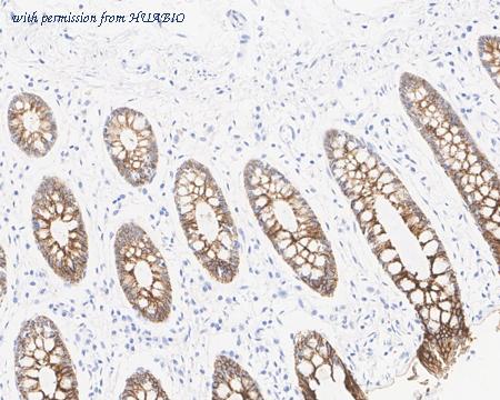 HUABIO HA721643 image 3