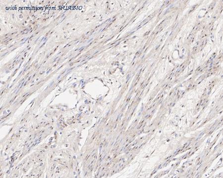 HUABIO HA721656 image 2