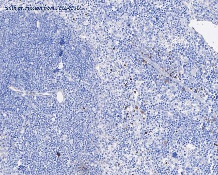 HUABIO HA721657 image 3