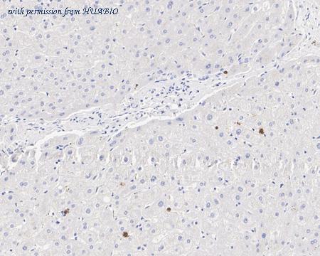 HUABIO HA721670 image 2