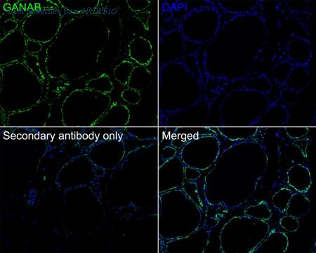 HUABIO HA721696 image 2