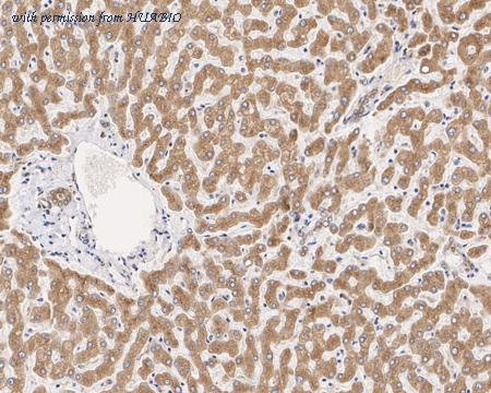 HUABIO HA721696 image 3