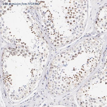 HUABIO HA721700 image 2