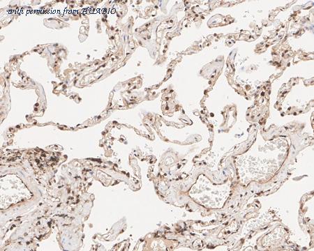 HUABIO HA721701 image 2