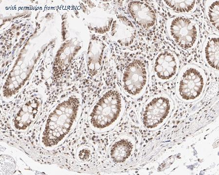 HUABIO HA721703 image 2