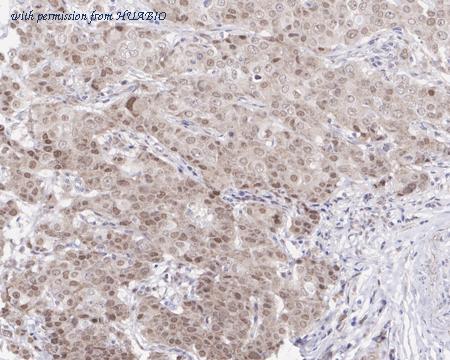 HUABIO HA721711 image 2