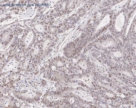 HUABIO HA721711 image 3