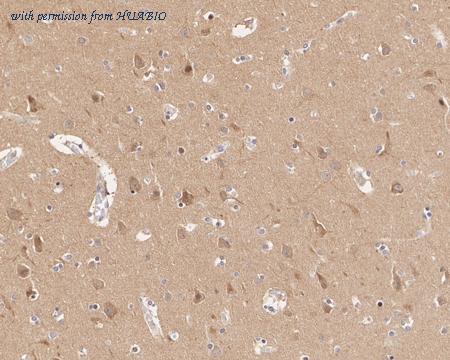 HUABIO HA721717 image 2