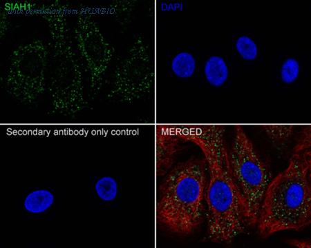 HUABIO HA721732 image 3