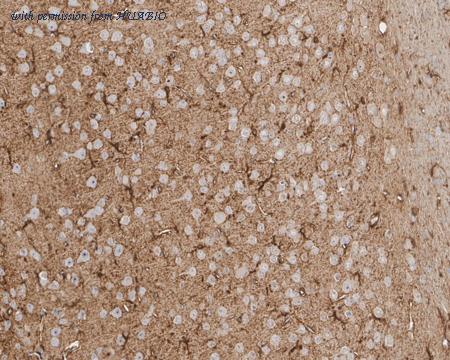 HUABIO HA721734 image 2