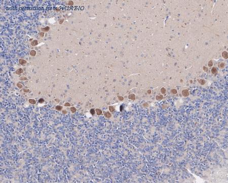 HUABIO HA721740 image 2