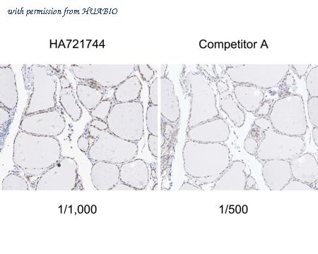 HUABIO HA721744 image 2