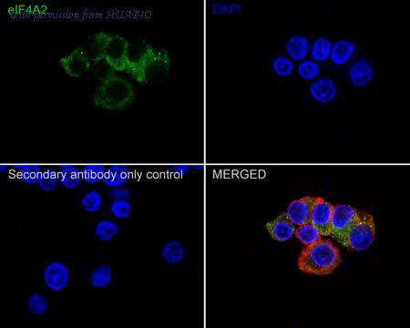 HUABIO HA721746 image 2