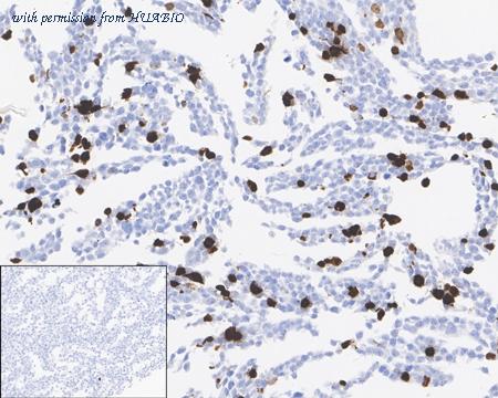 HUABIO HA721751 image 2