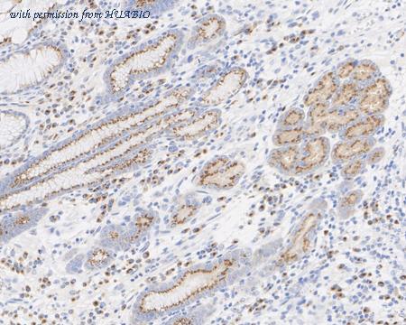 HUABIO HA721754 image 3