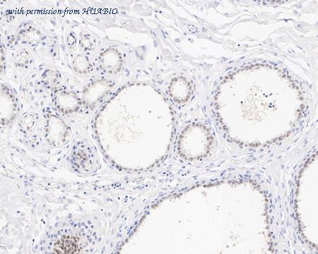 HUABIO HA721764 image 3