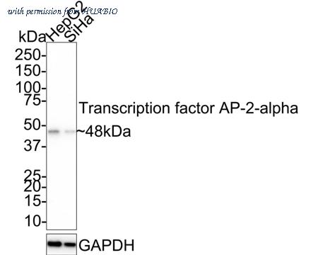 HUABIO HA721765 image 1