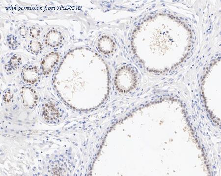 HUABIO HA721765 image 3