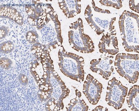 HUABIO HA721771 image 3