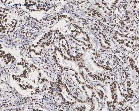 HUABIO HA721803 image 2