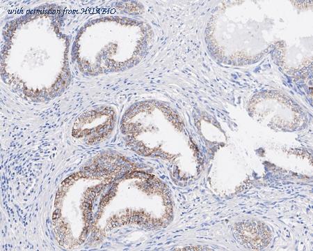 HUABIO HA721807 image 2