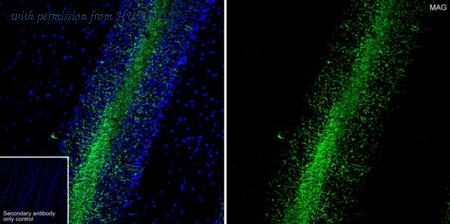 HUABIO HA721818 image 2