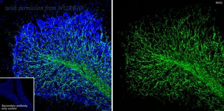 HUABIO HA721818 image 3