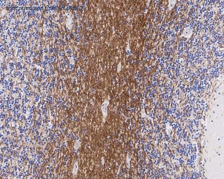 HUABIO HA721819 image 2